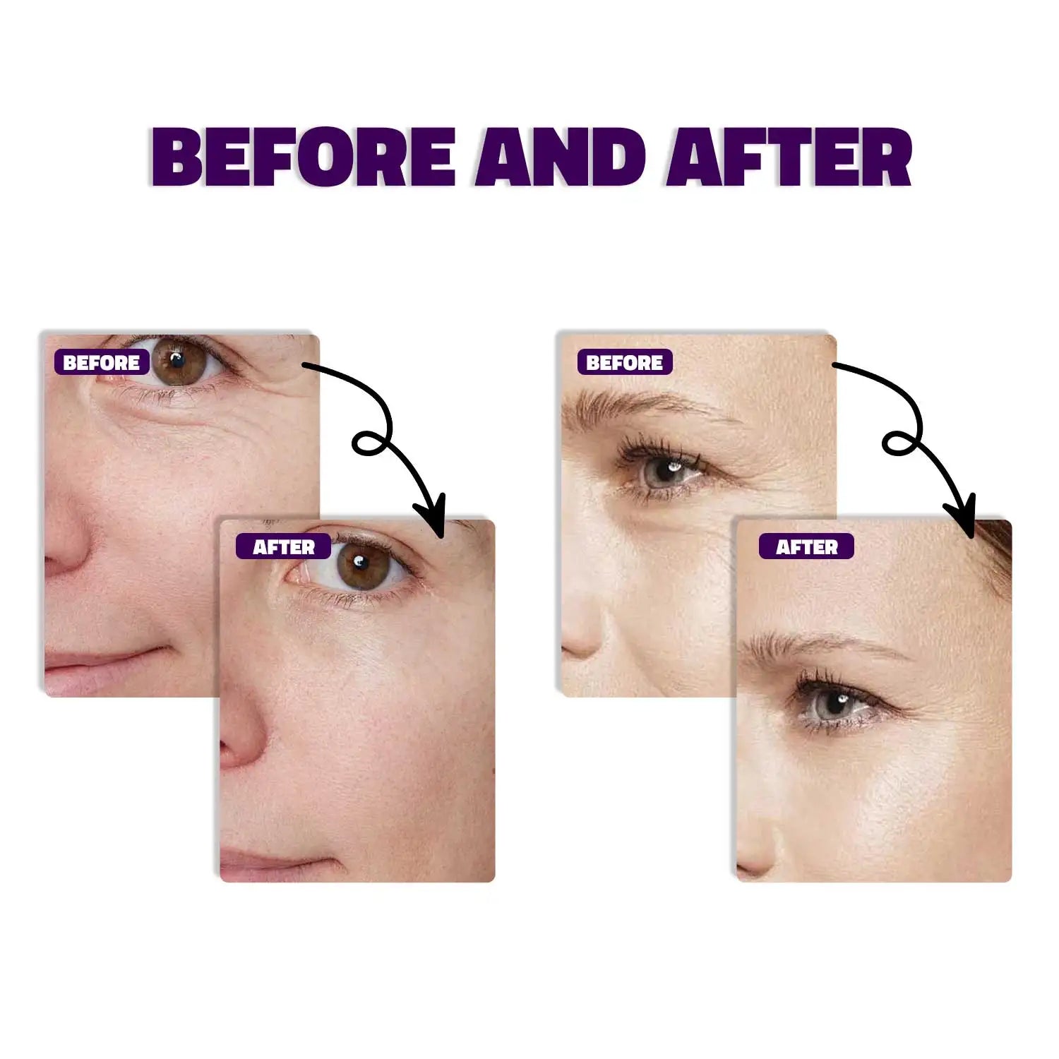 Astrell Bakuchiol Renewal Serum